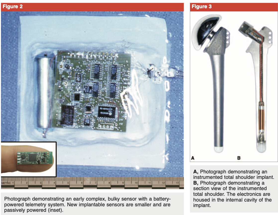 Same article — Figure 2: bulky battery telemetry, then a fingertip-scale passive chip. Figure 3: electronics inside a shoulder stem.
