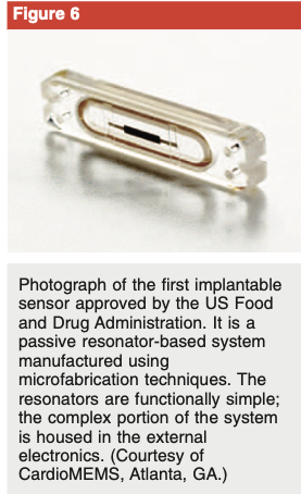 Same article — Figure 6: CardioMEMS, the first FDA-approved implantable sensor. Cardiac. Not a hip.