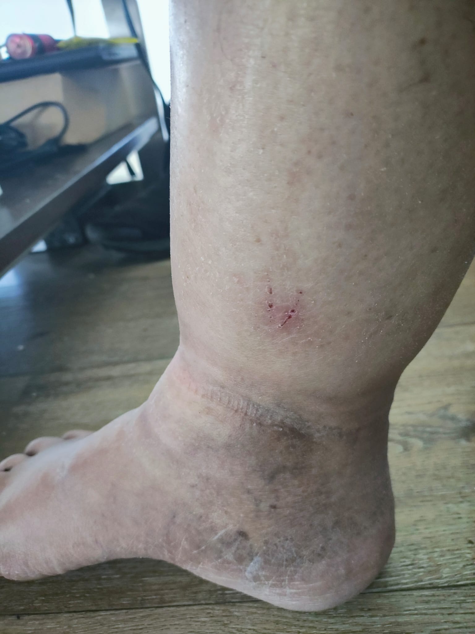 Medial ankle, a scar, some marks. One of the stills in the same dump.