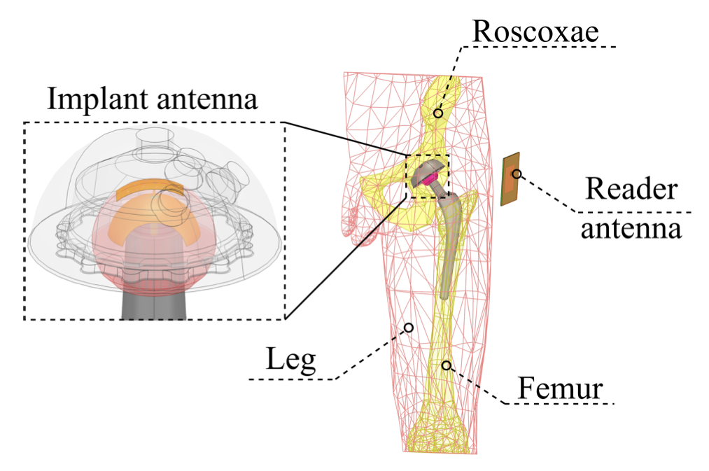 FEM — implant antenna in the femoral head, reader antenna outside the body. Labels: Roscoxae, Leg, Femur.
