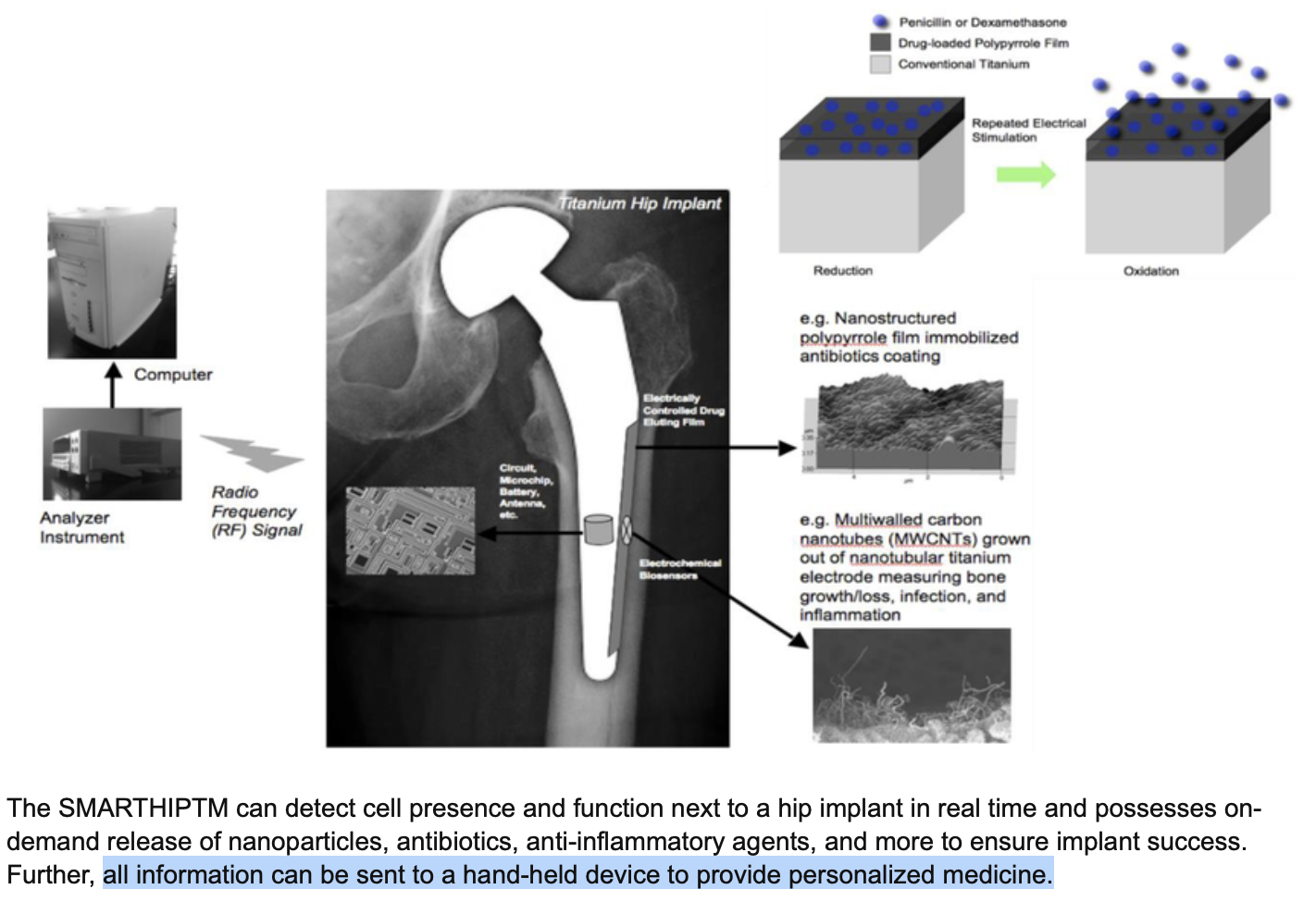 Webster SMARTHIP™ figure — RF to a handheld; nanoparticle release as a concept