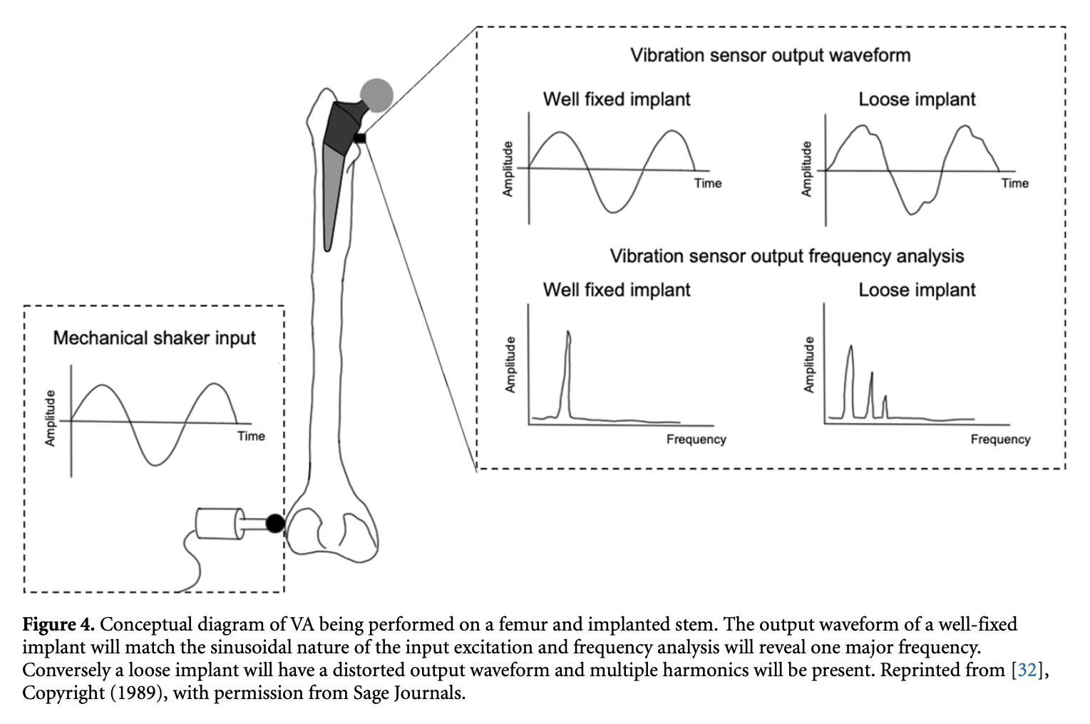 Vickers Figure 4 — vibration analysis with an external shaker. Well-fixed vs loose. A diagnostic method.